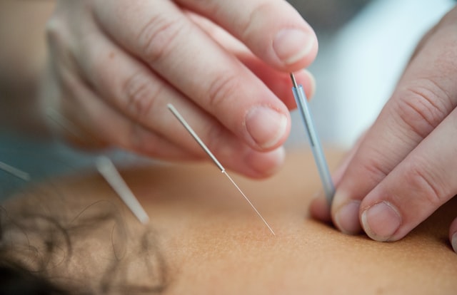 Meilleures cliniques d'acupuncture à Winnipeg
