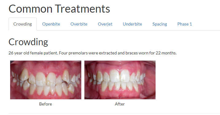 Orthodontie ClearView